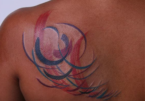 Disappearing Ink: New Tattoo Removal Method - SPA+CLINIC