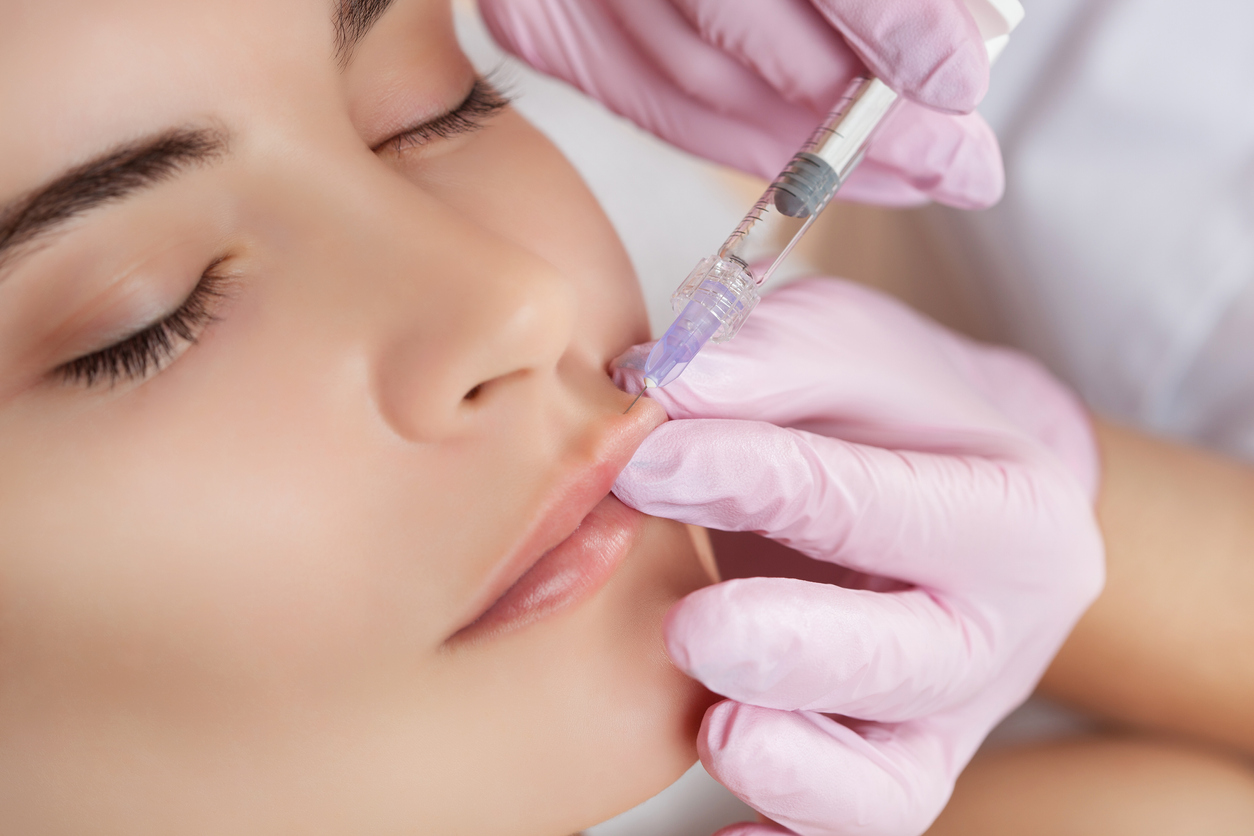 What to Expect From Your First Lip Filler Treatment - My Botox LA Med Spa  News & Articles